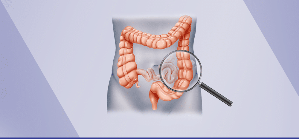 rastreamento do câncer colorretal